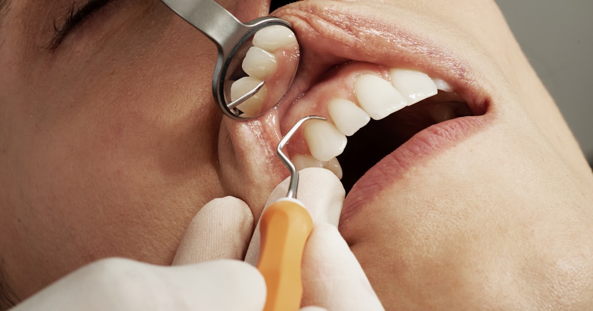 Interdental care and dental hygiene tools