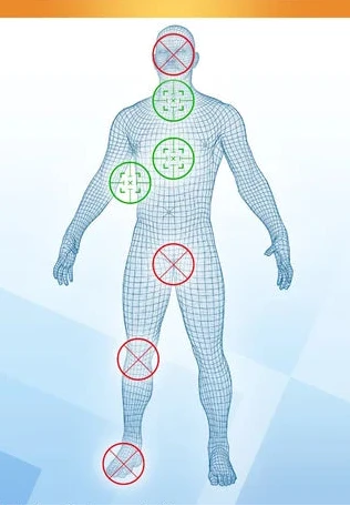 EndWarts Extra fibroid cryotherapy 14.3 g