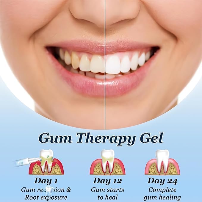 Lovilds Gum Protect Therapy Gel 4 x 10 ml