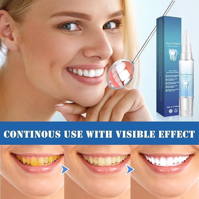 Lovilds Gum Protect Therapy Gel 4 x 10 ml